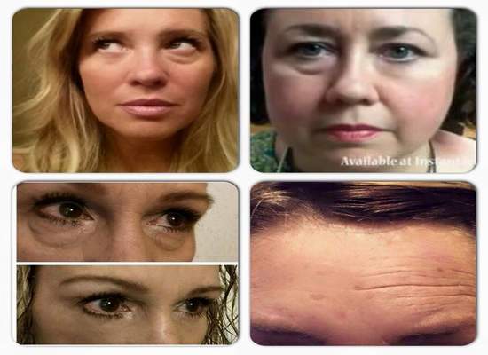 Instantly Ageless – A powerful anti aging cream