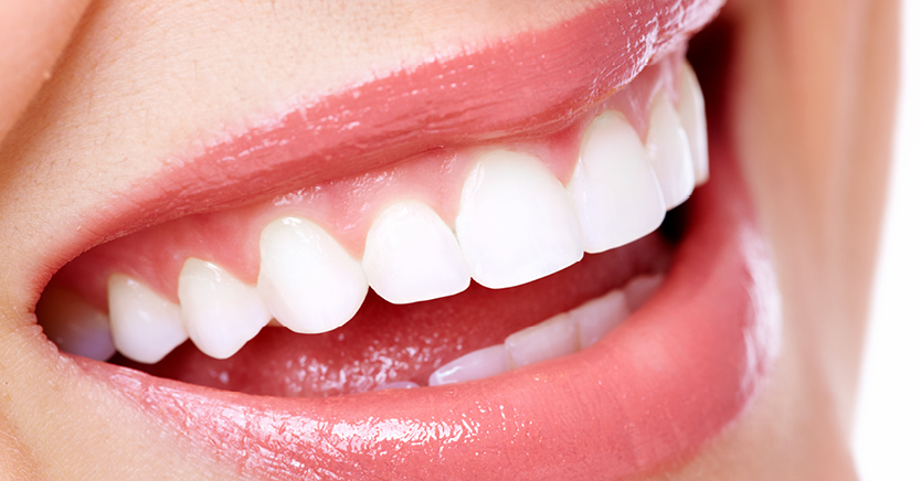 Tips for a Dazzling White Smile